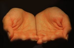 Pijn ervaren als leermeester, niet als vijand