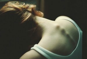 Anorexia: wanneer te dun zijn slechts het topje van de ijsberg is