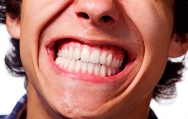 Een man die last heeft van tandenknarsen