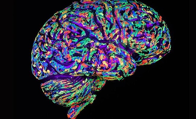 Een kleurrijk, reagerend brein