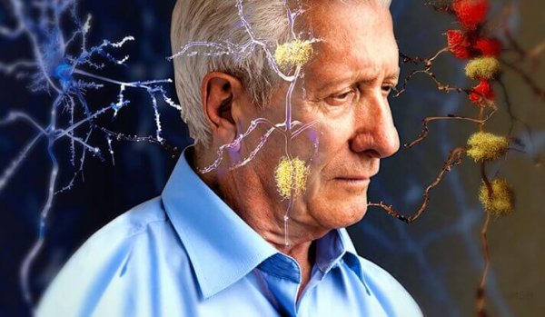 Verbindingen in de hersenen van een oudere man