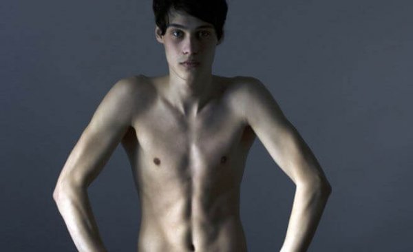 Problemen tijdens de adolescentie met voeding