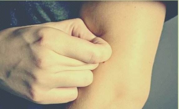 Meisje pulkt aan haar huid: dermatillomanie