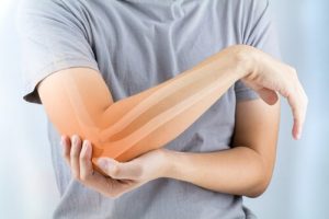 Reumatoïde artritis: symptomen, oorzaken en behandeling
