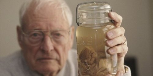 Thomas Harvey met het brein van Einstein