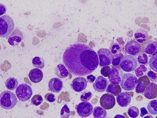 menselijk immuunsysteem cellen onder microscoop