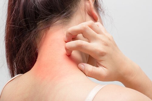 Atopische dermatitis in de nek