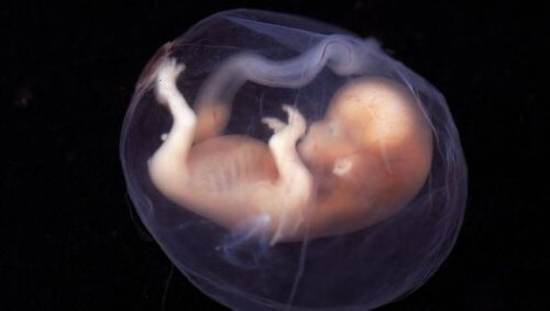 Foetus