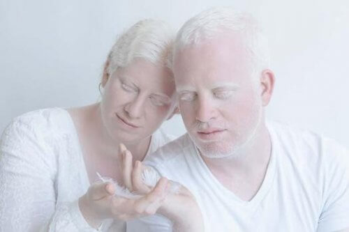 Koppel met albinisme