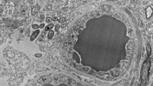 Microbioom uit de darmen in de hersenen