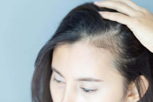 De psychologische gevolgen van alopecia bij vrouwen