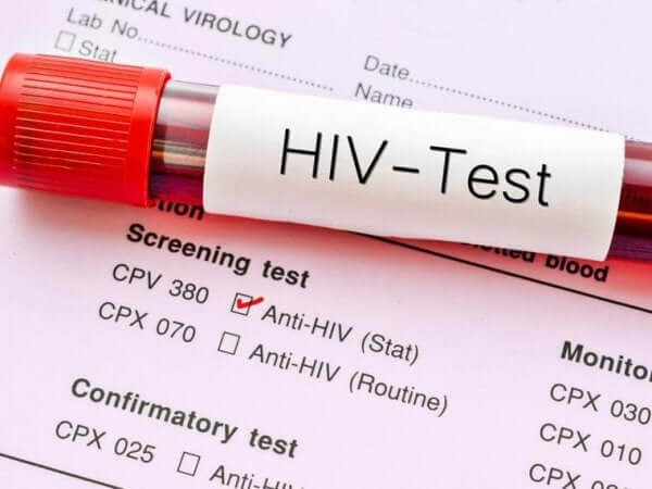 Denk na over een hiv-test op wereldaidsdag
