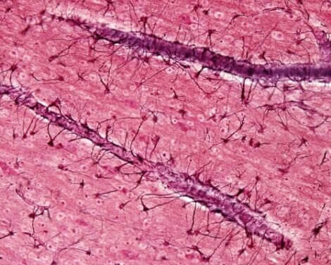 Een afbeelding van bloedvaten