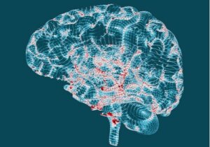 Ziekte van Huntington: kenmerken en symptomen