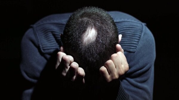 Het verband tussen alopecia areata en stress