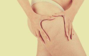 Lipoedeem: meer dan obesitas