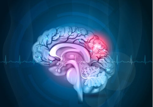 Wat is een chemobrein precies?